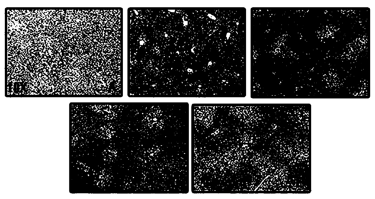 Application of Long Hu Ren Dan in prevention and treatment of drug-induced liver injury