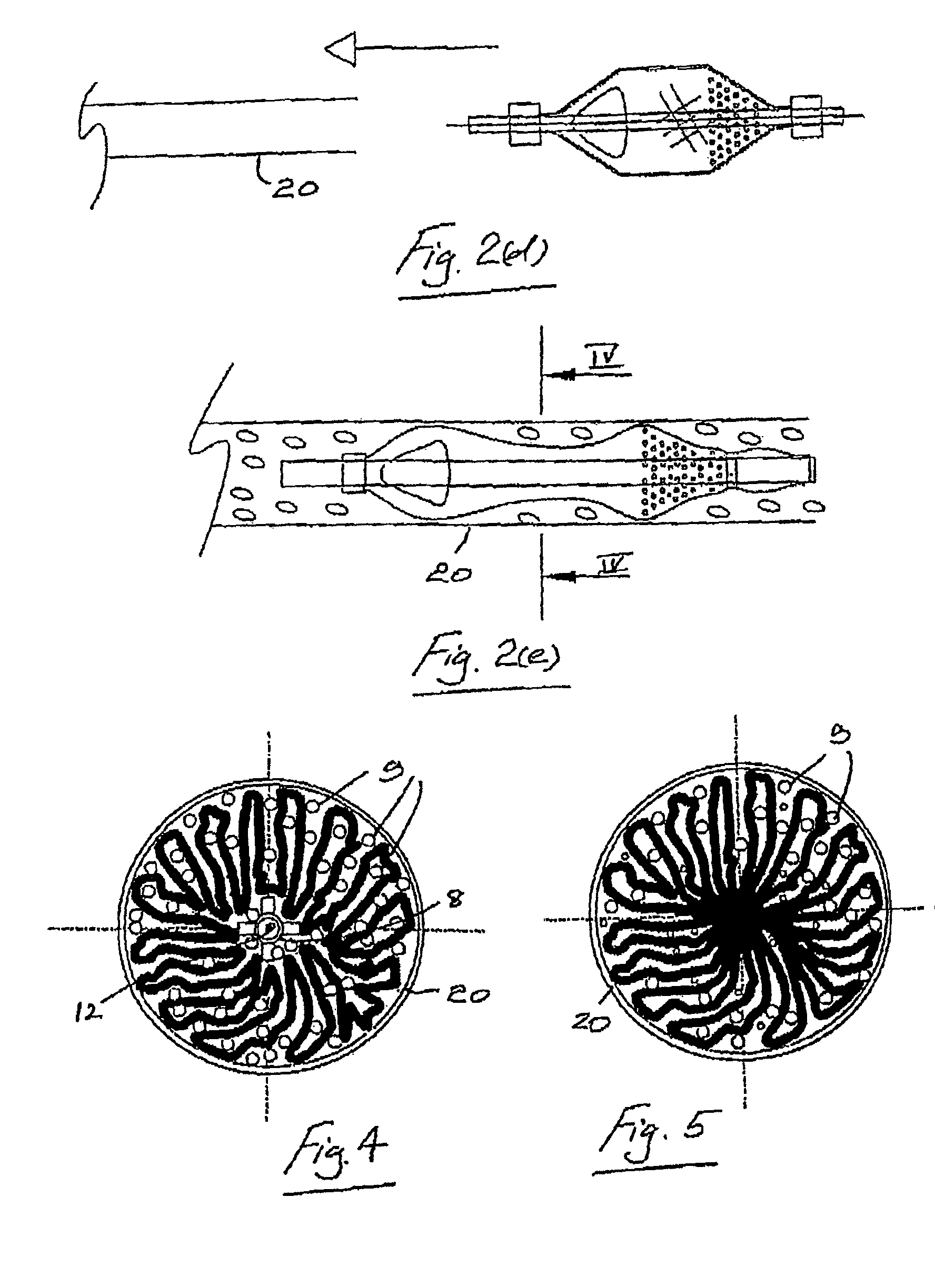 Embolic protection system