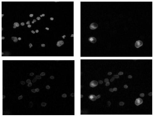 A negative enrichment method for circulating tumor cells