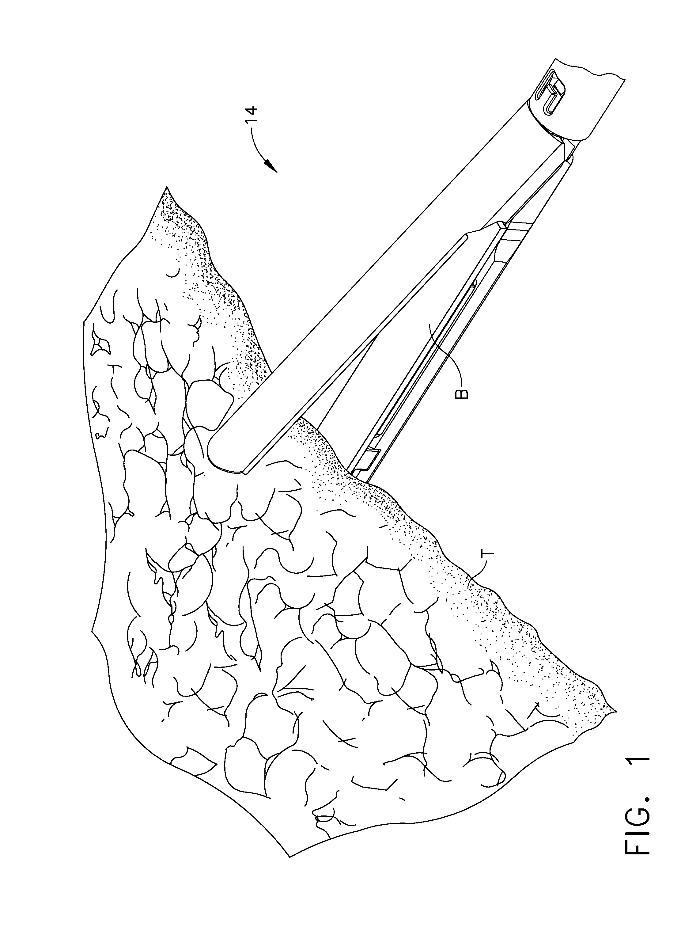 Layer arrangements for surgical staple cartridges