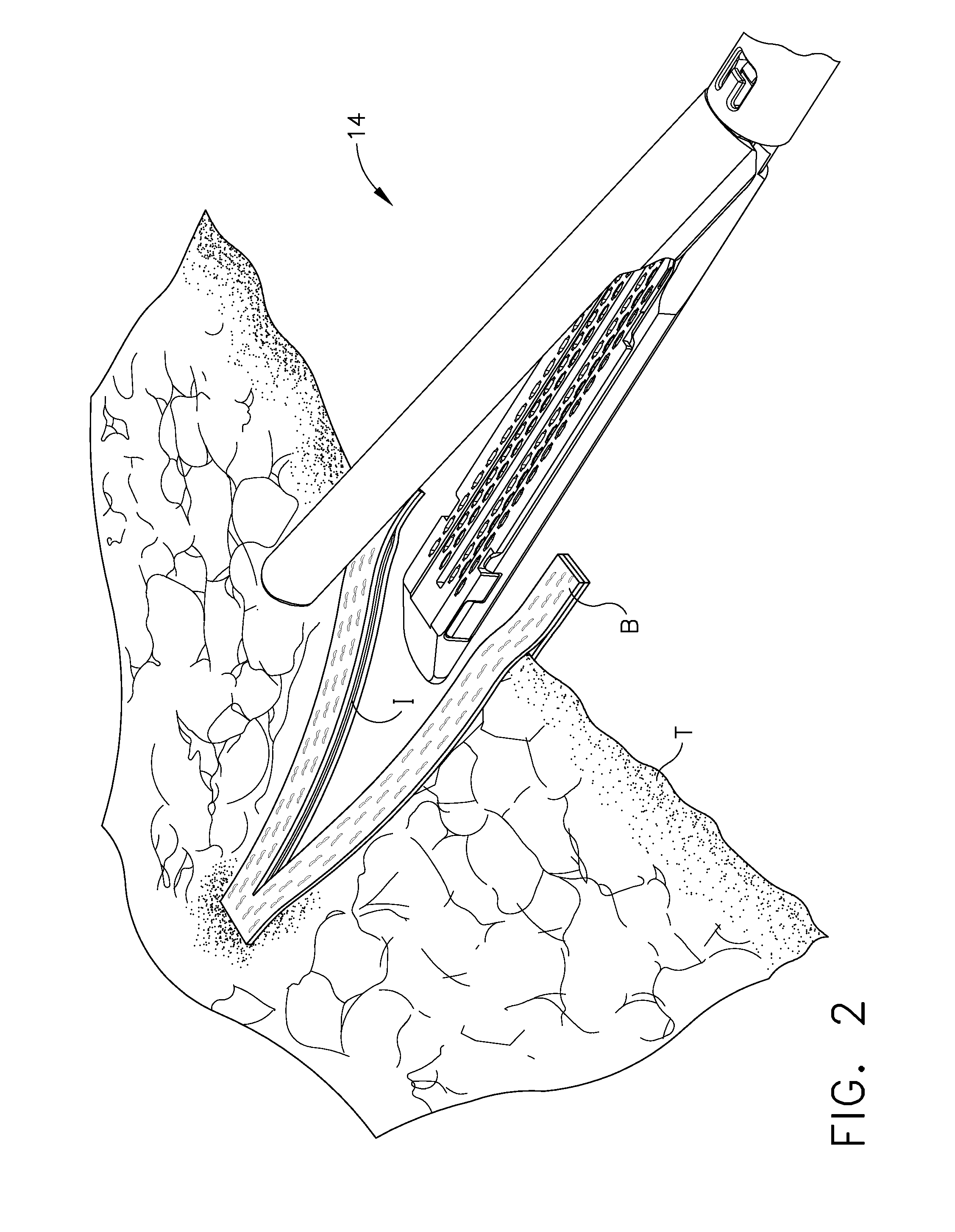 Layer arrangements for surgical staple cartridges