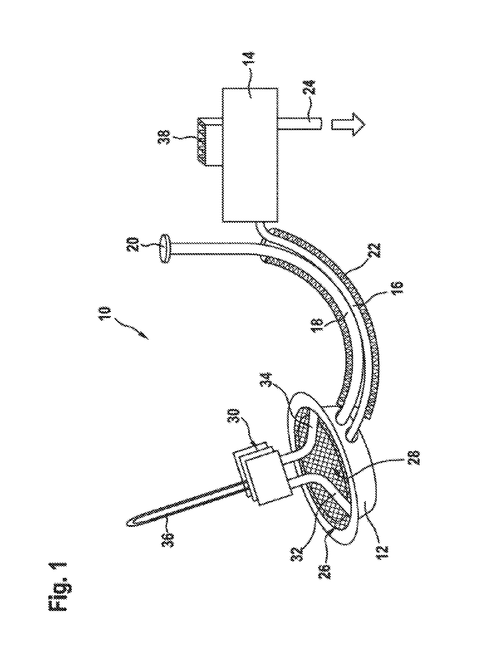 Device for supplying a reducing agent to an exhaust-gas aftertreatment system