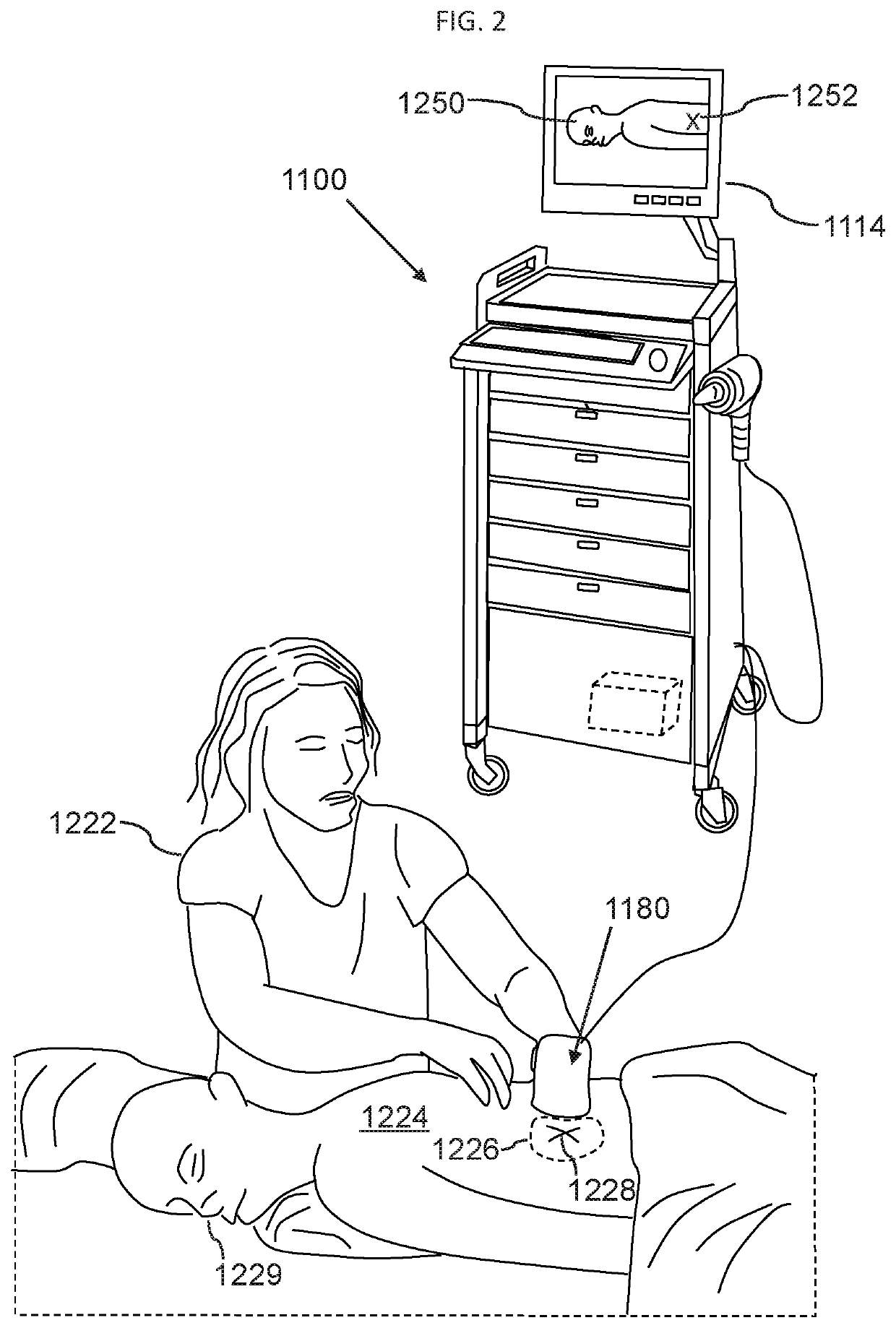 Trigger point treatment method, system, and device for neuromusculoskeletal pain