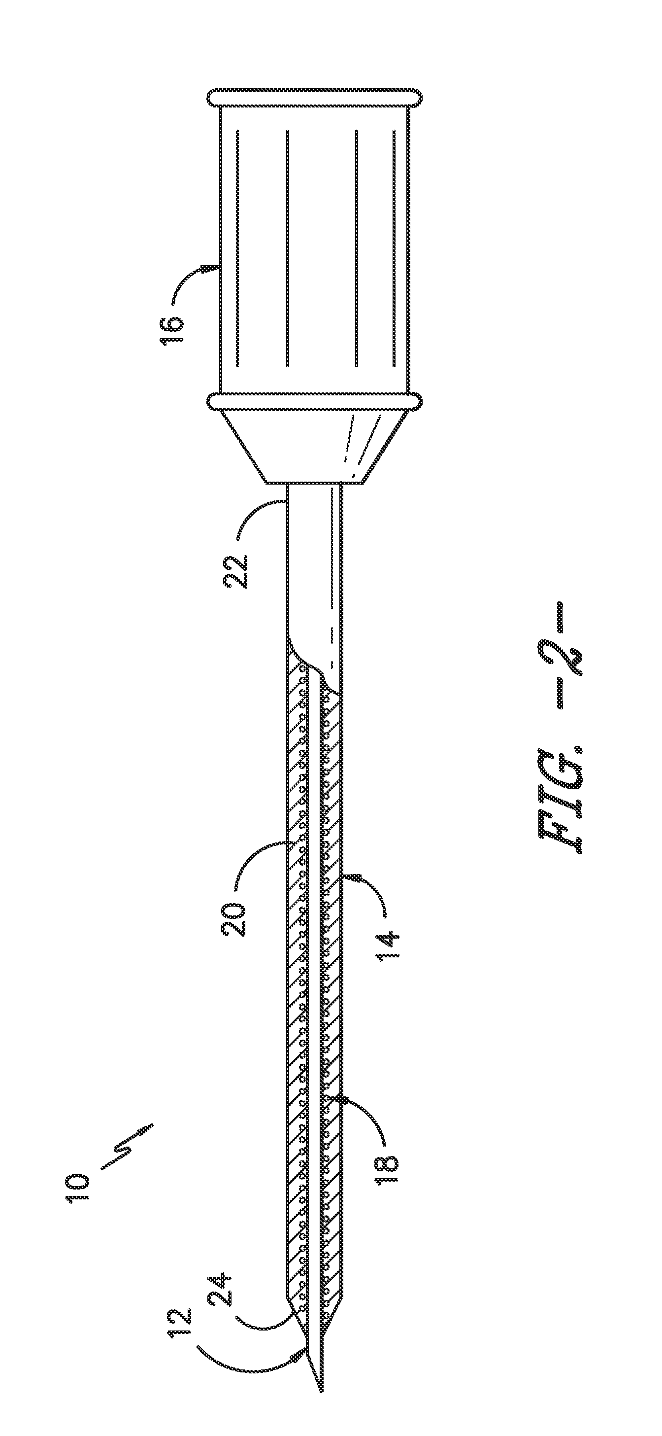 Over-the-Needle Catheter Insert