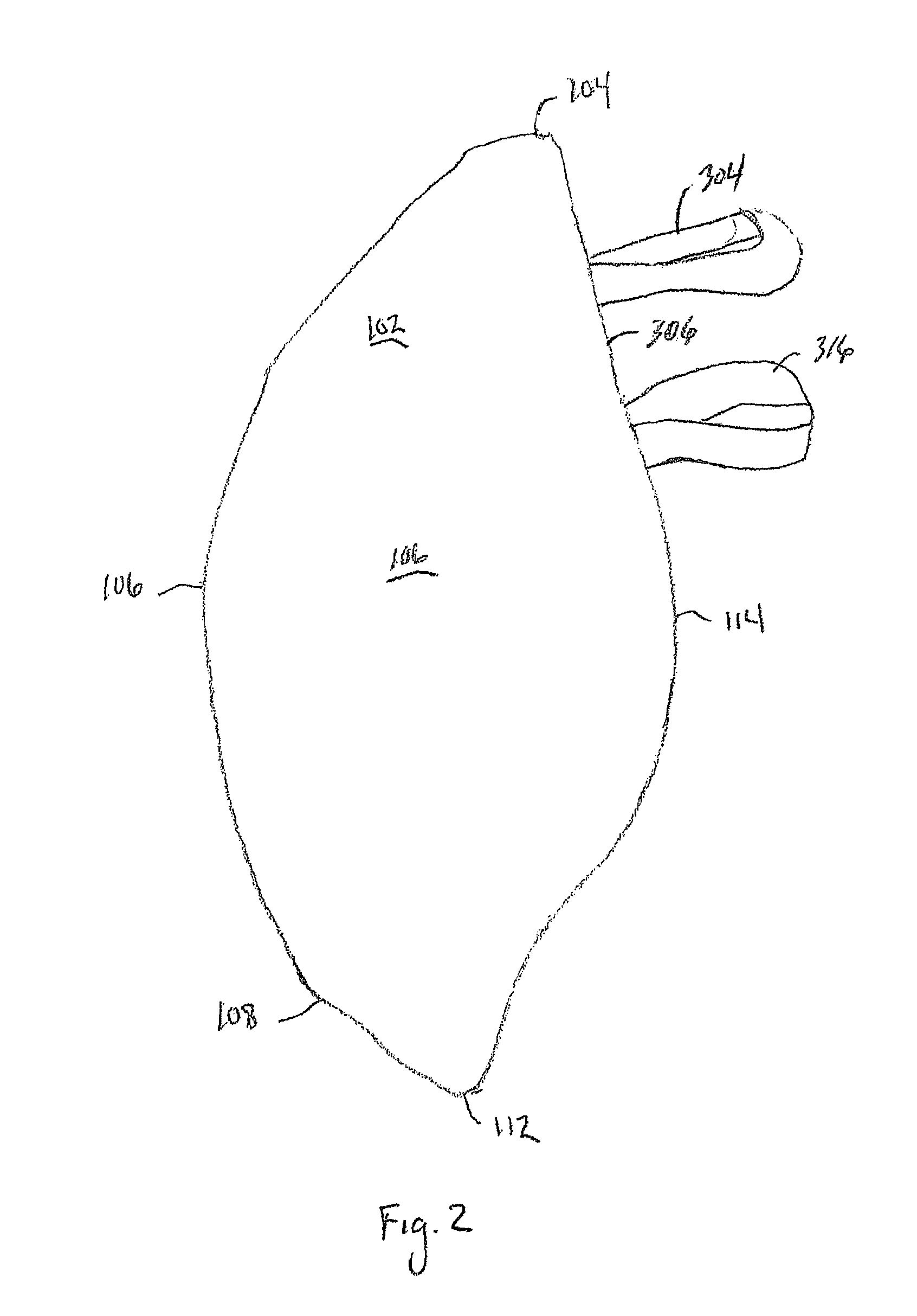 Prosthetic apparatus and method