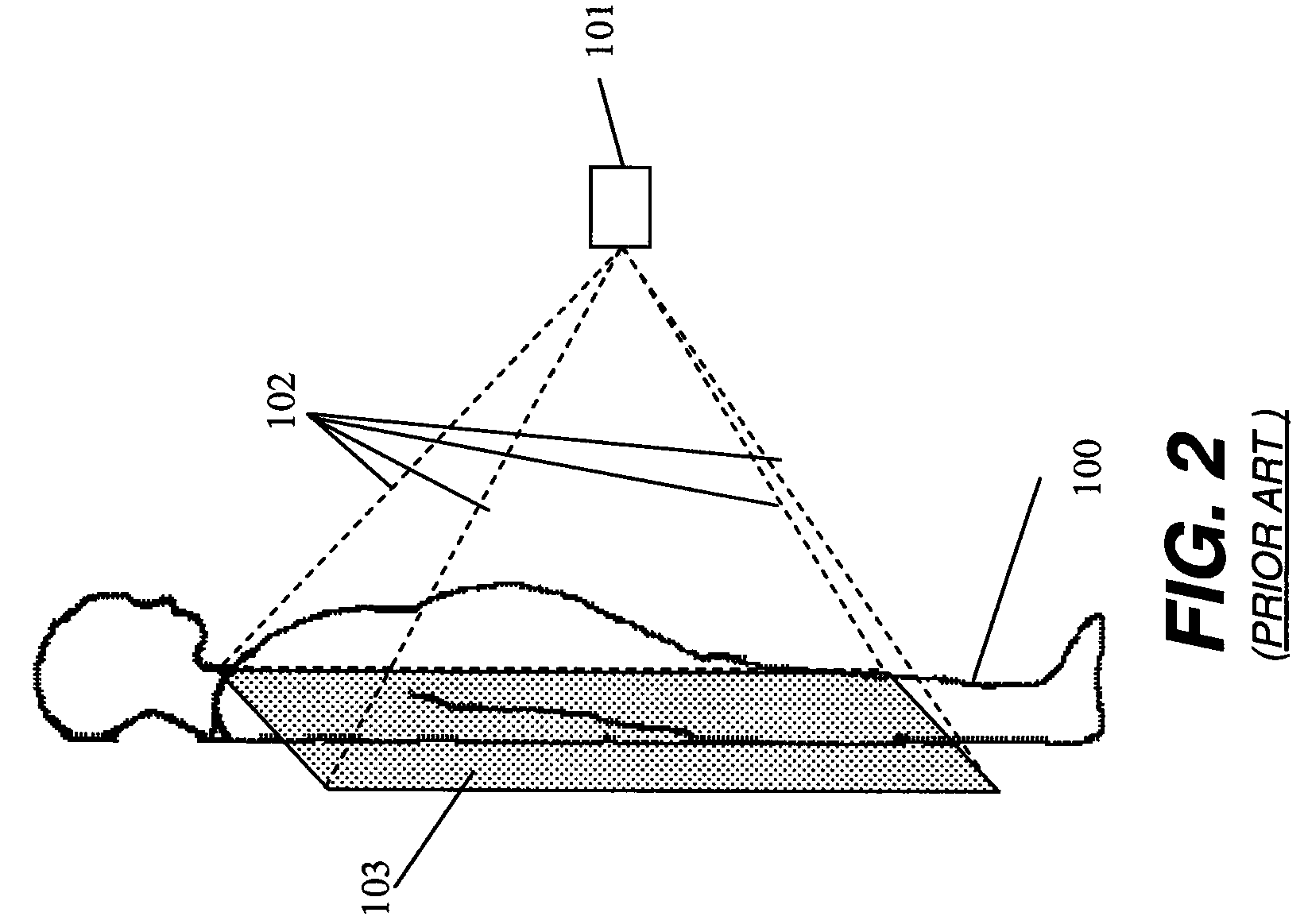 Long length imaging using digital radiography