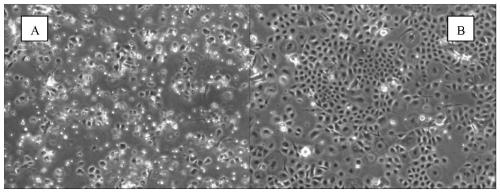 Cell suspension for repairing striae gravidarum and preparation method of cell suspension for repairing striae gravidarum