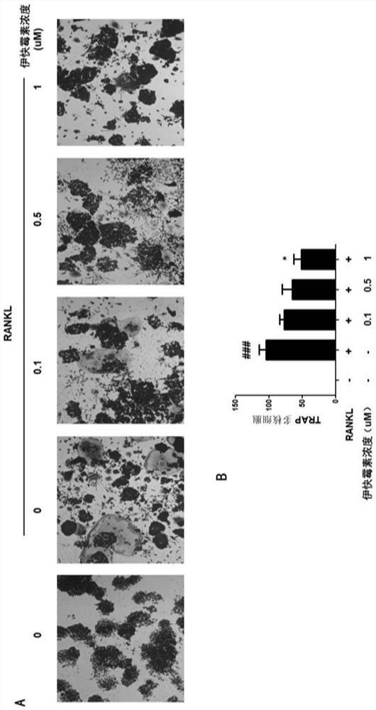 Application of equisetin to preparation of osteoclast differentiation inhibitor