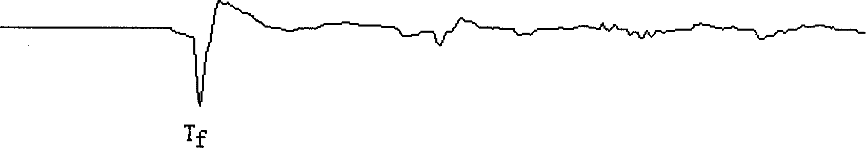 Sectional detection method of small current earthing fault of power system