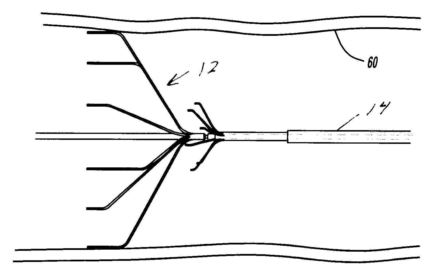 System and method for retrieval of a medical filter