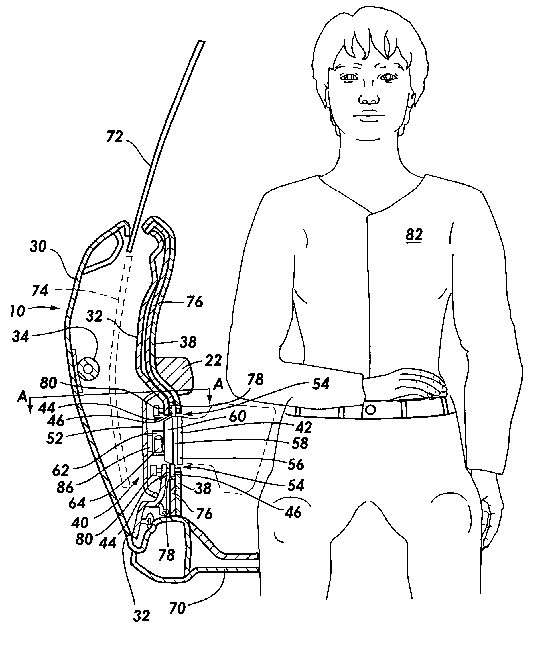 Expandable pelvic side airbag