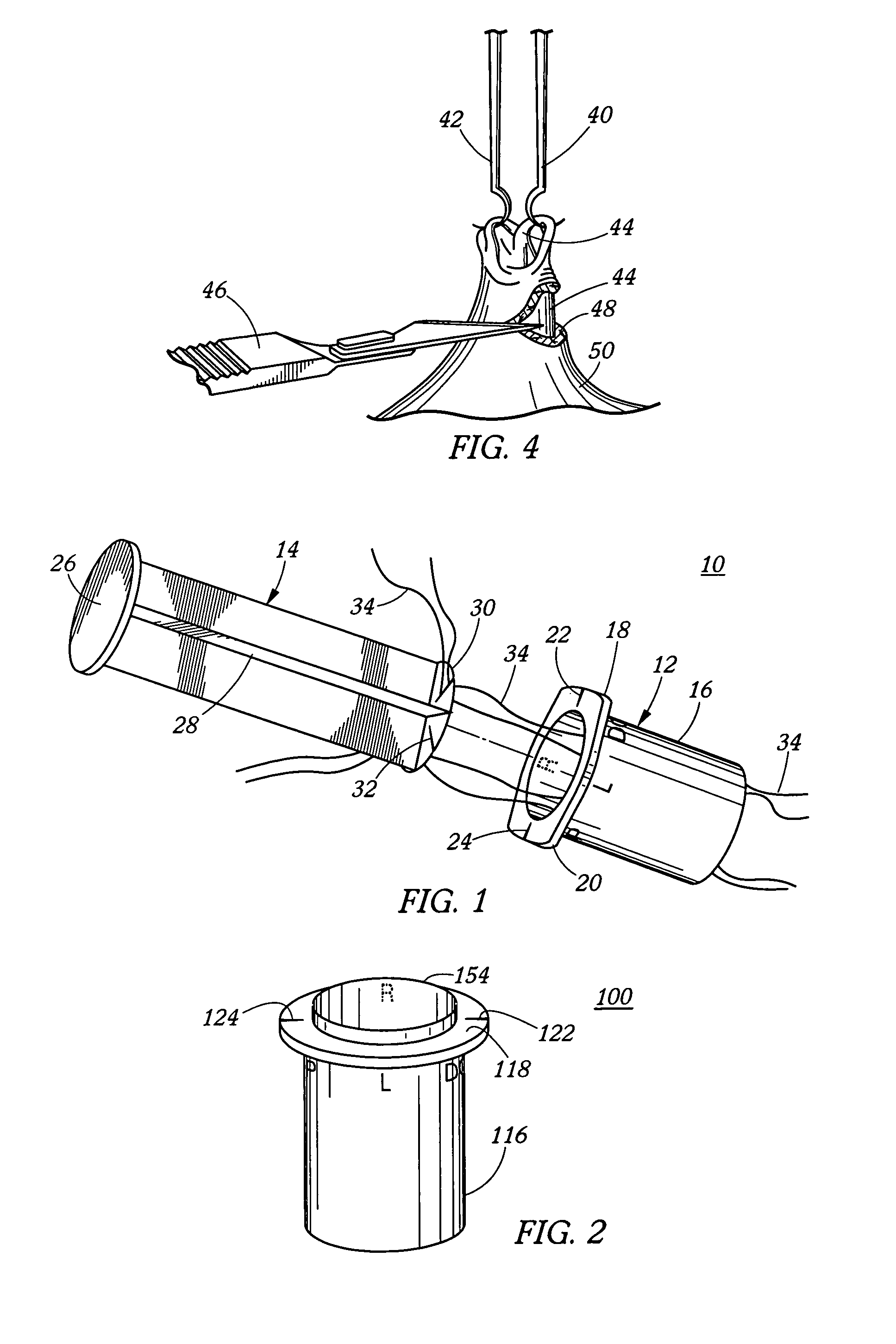 Method and device for umbilicus protection during abdominal surgery