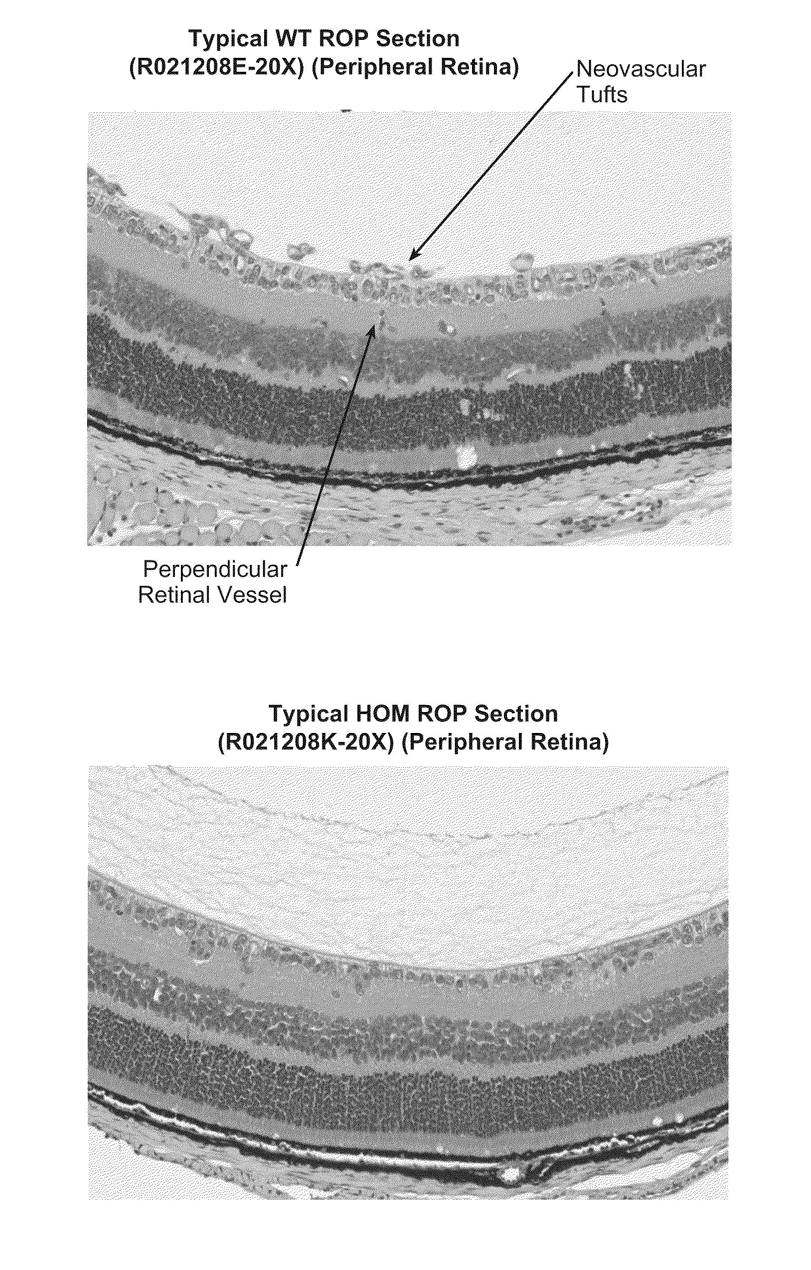 Methods for inhibiting ocular angiogenesis