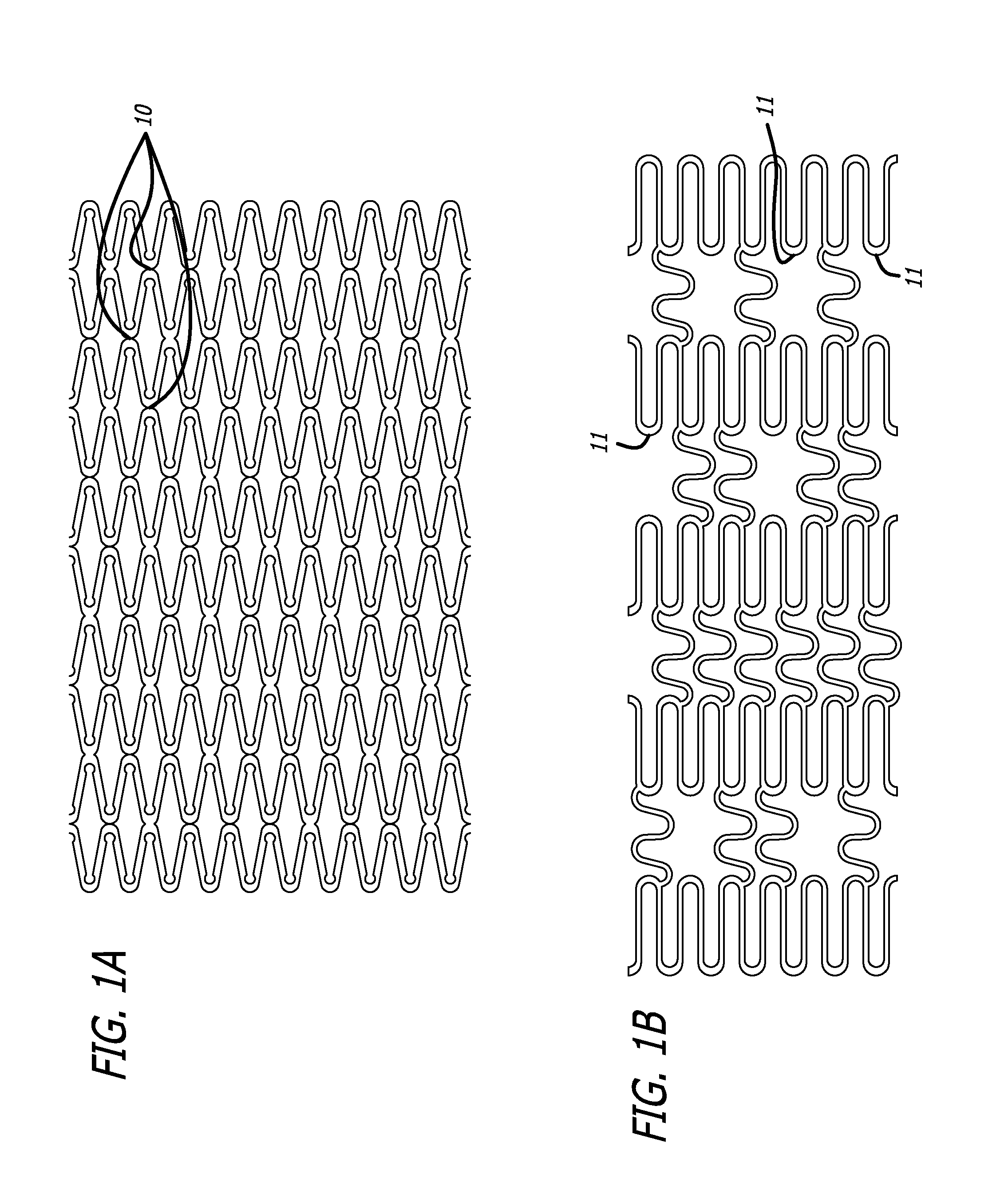 Tethered Self-Expanding Stent Delivery System