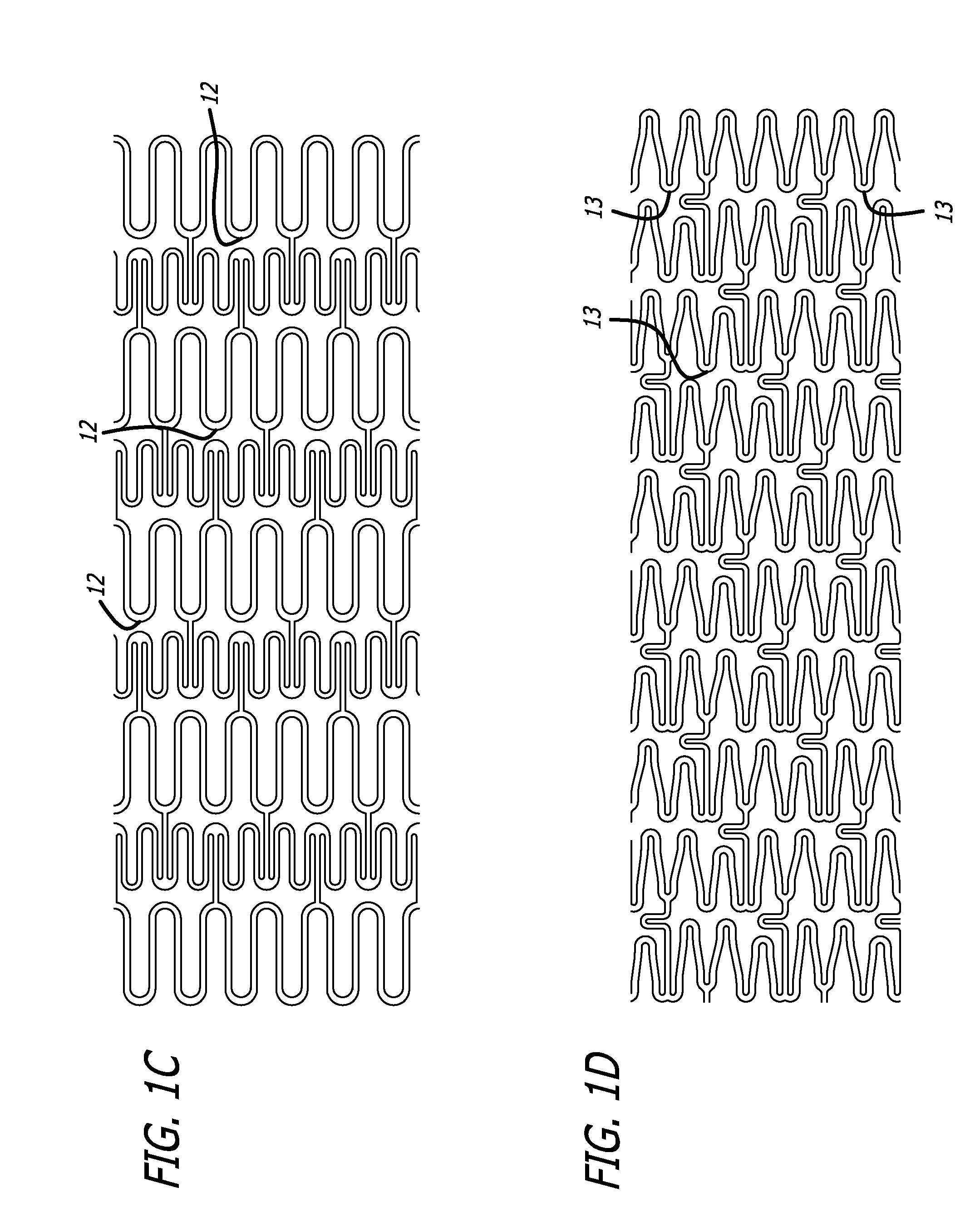 Tethered Self-Expanding Stent Delivery System