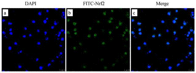 Method for establishing tumor multi-drug resistant cell mode and human breast cancer multi-drug resistant cell strain established by virtue of method