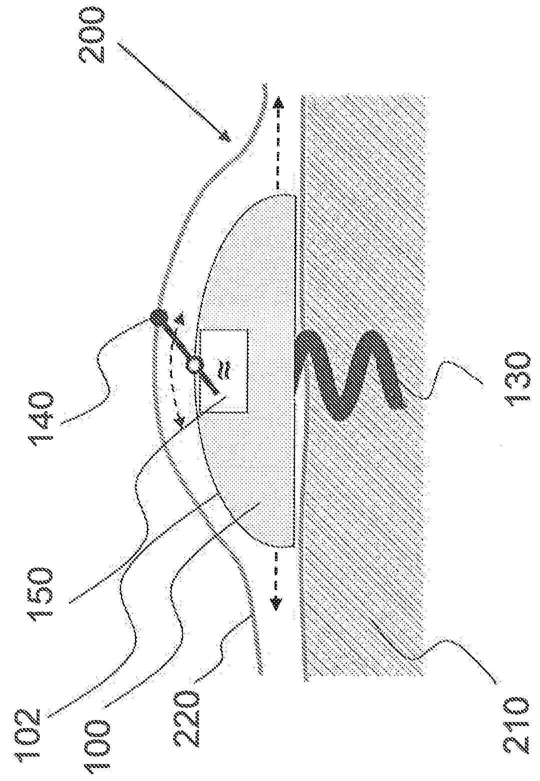 Medical implant