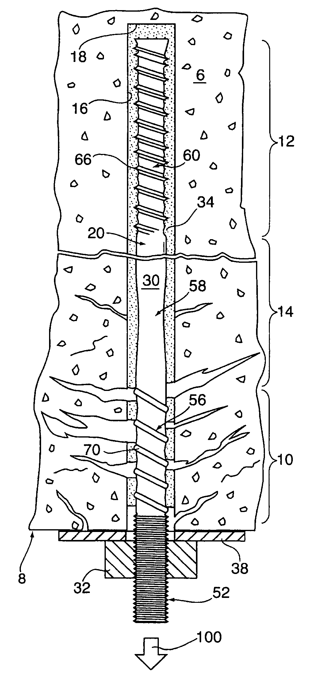 Anchor tendon with selectively deformable portions