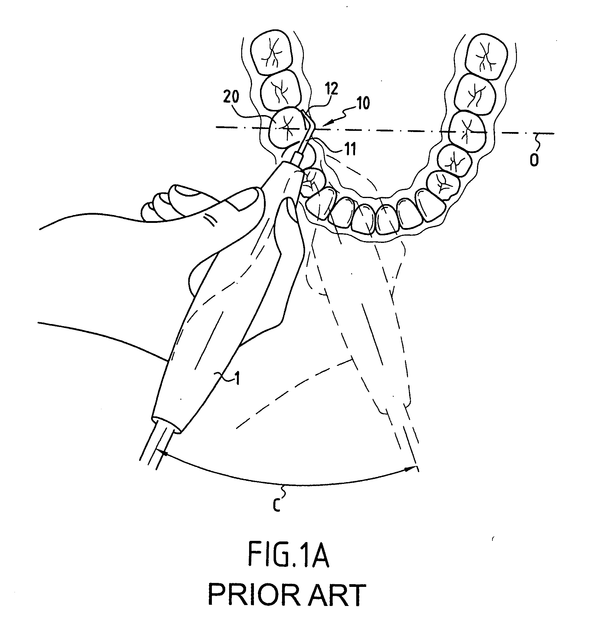 Cutting insert for a vibrating dental instrument