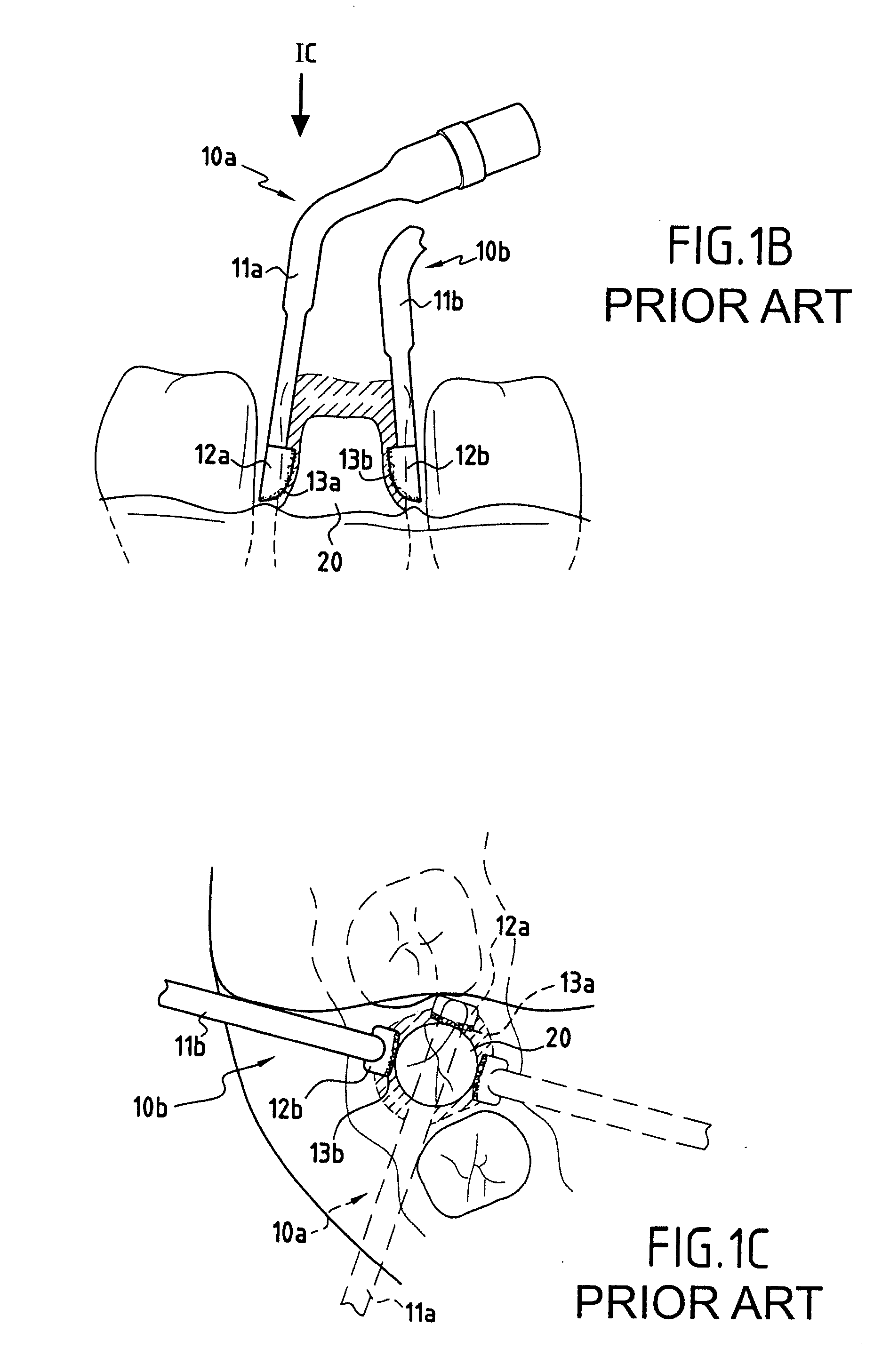 Cutting insert for a vibrating dental instrument