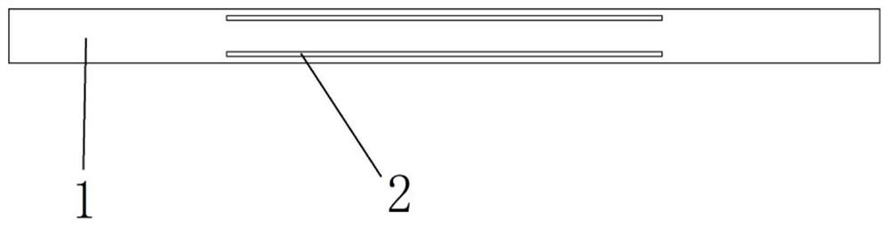 Posterior scleral reinforcement structures visualized by MRI