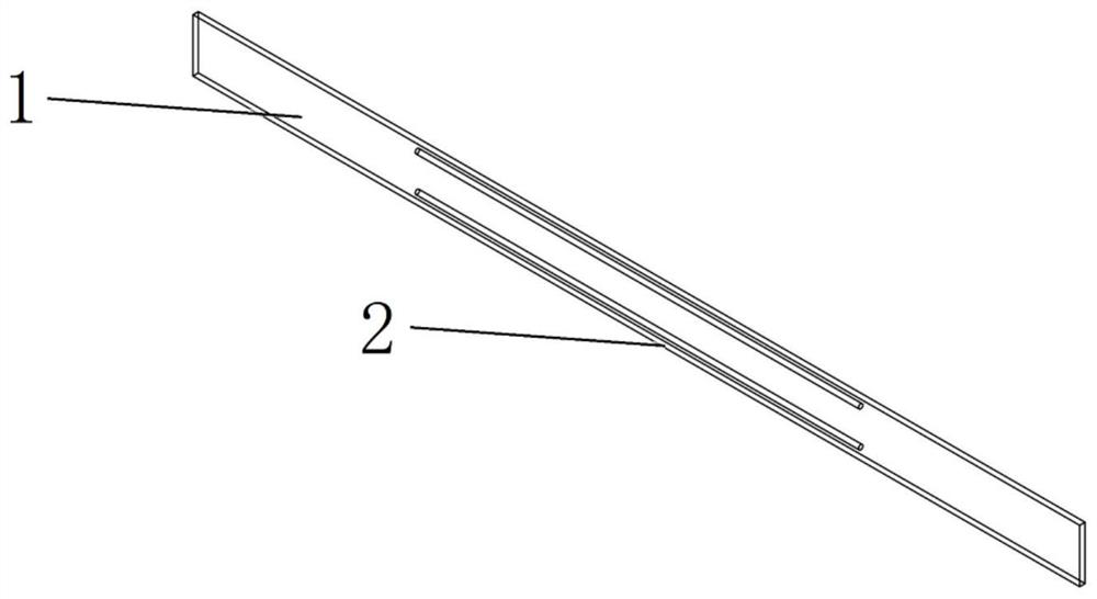 Posterior scleral reinforcement structures visualized by MRI