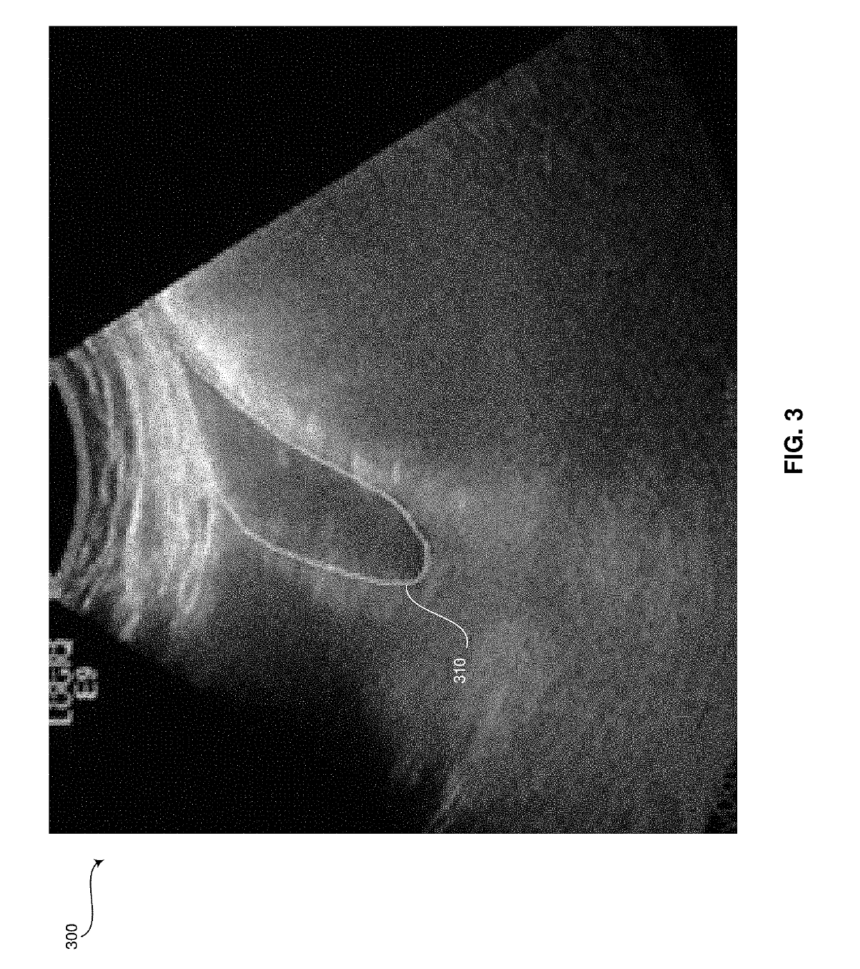 Method and system for creating and utilizing a patient-specific organ model from ultrasound image data