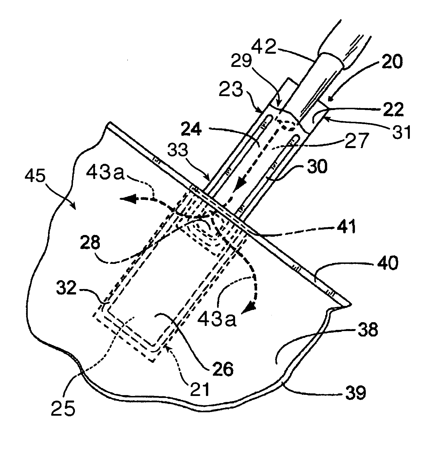 Flexible valves