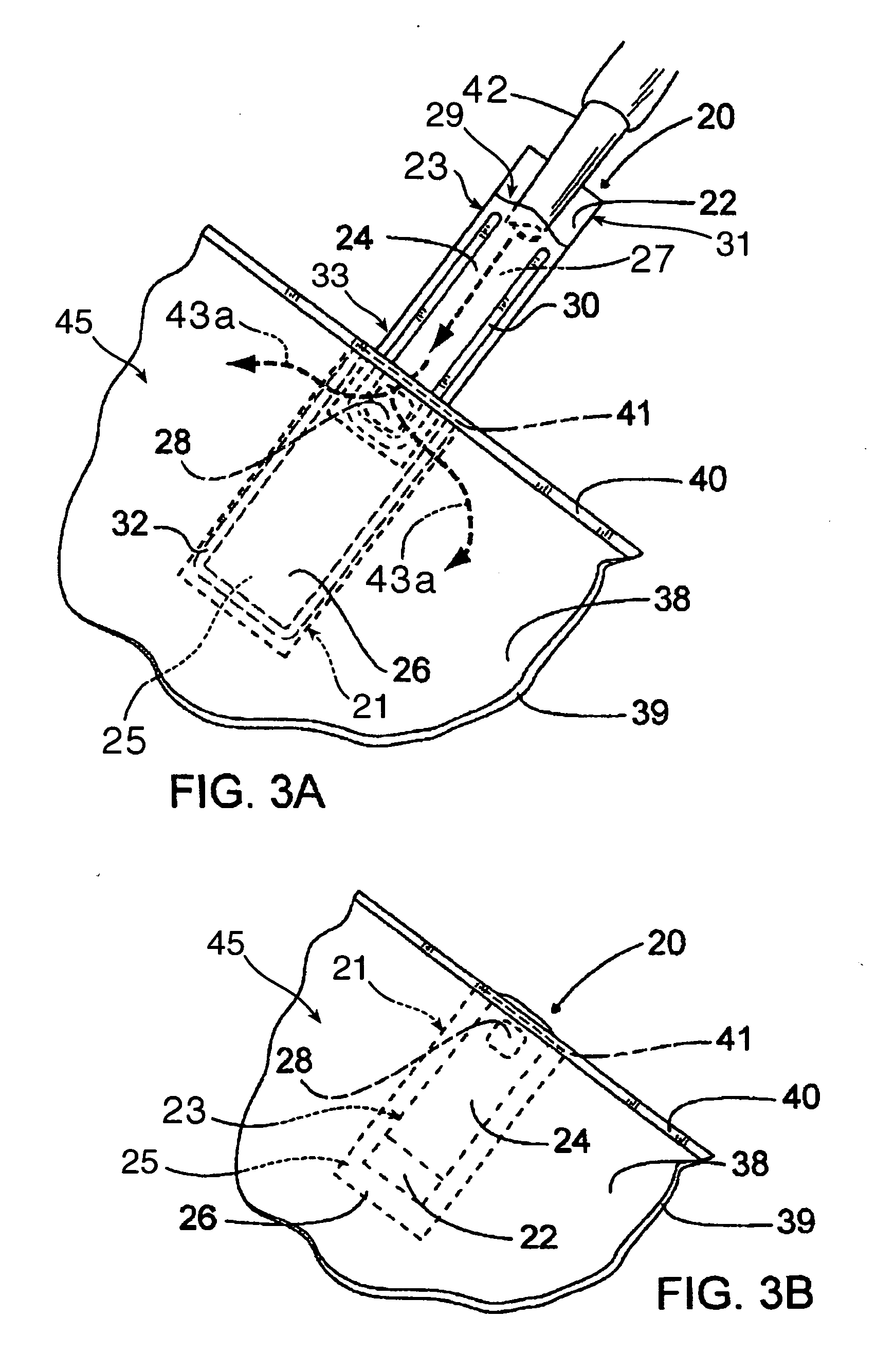 Flexible valves