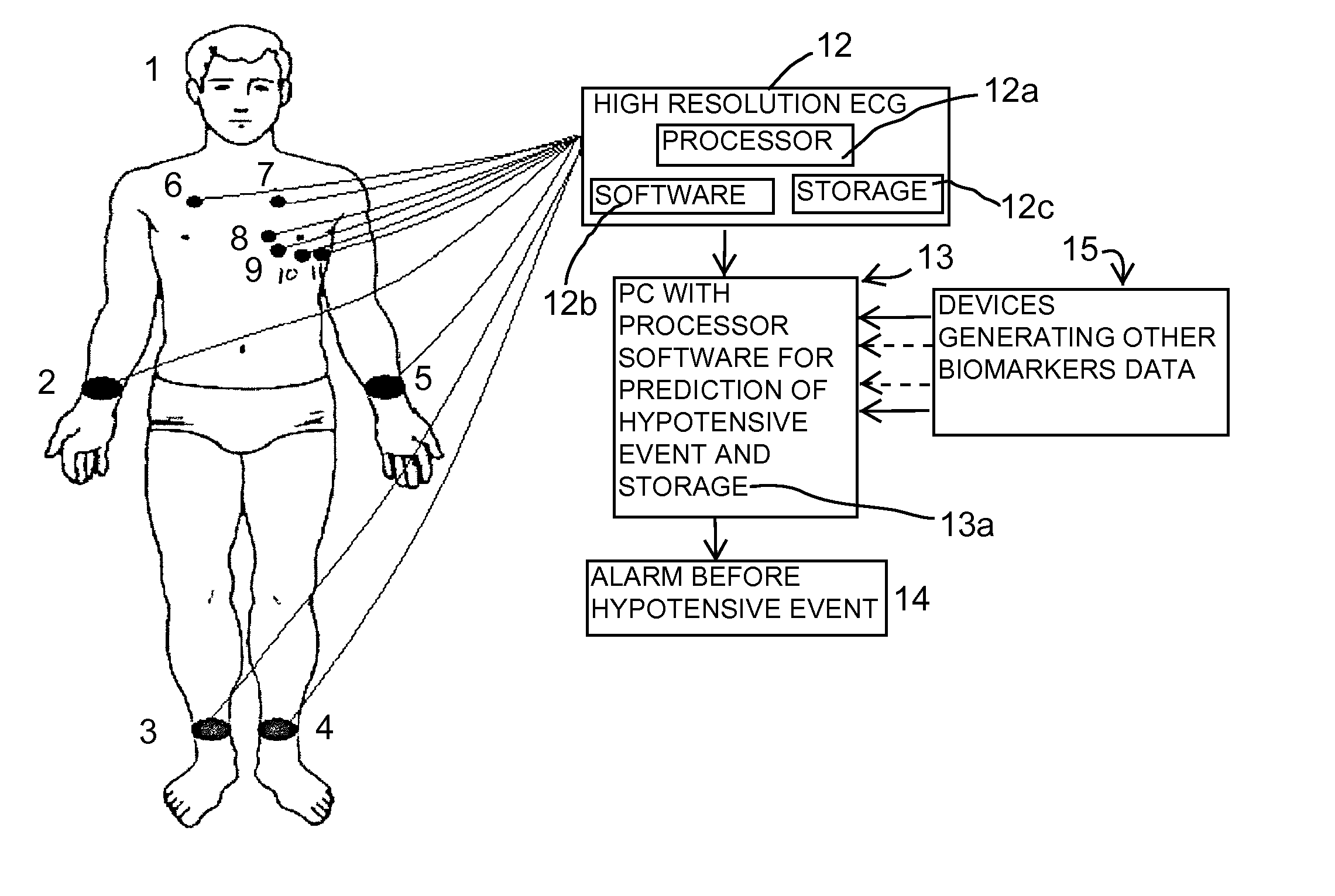 Method and System for Predicting of Acute Hypotensive Episodes