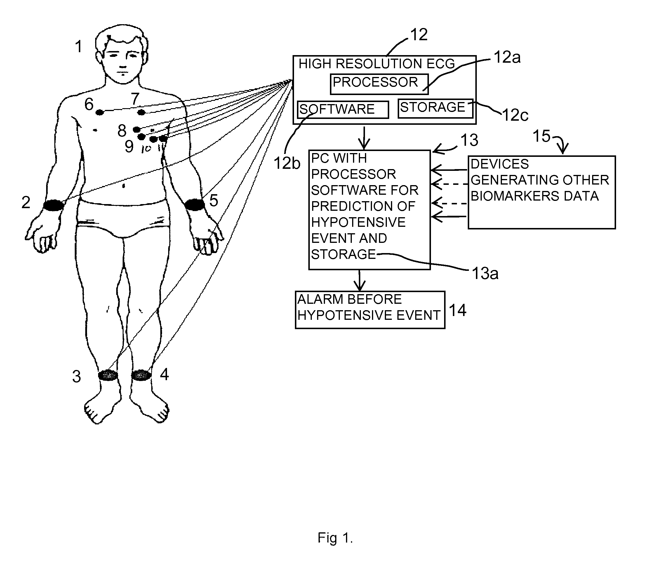 Method and System for Predicting of Acute Hypotensive Episodes