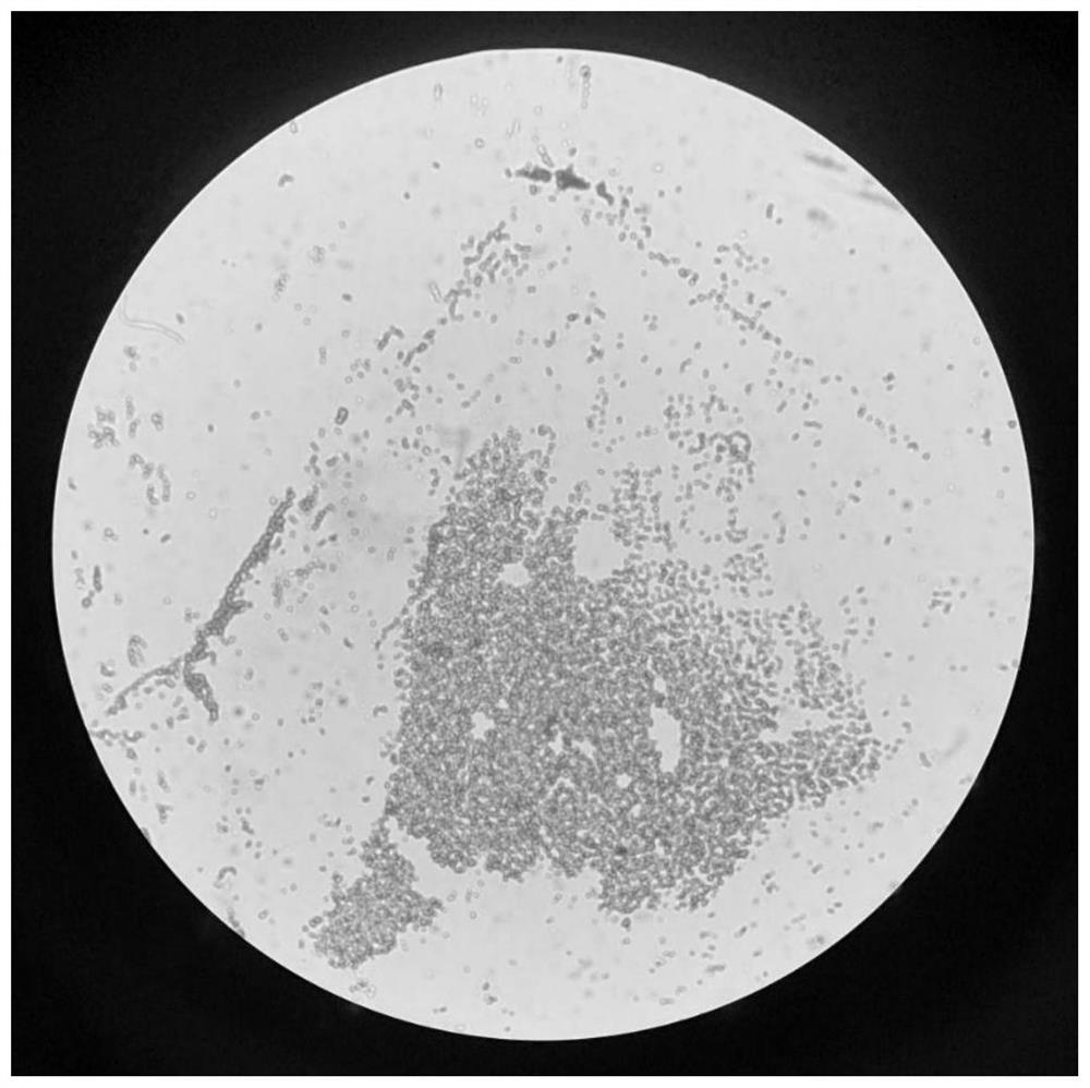 Heterotrophic nitrification-aerobic denitrification bacterium and application thereof