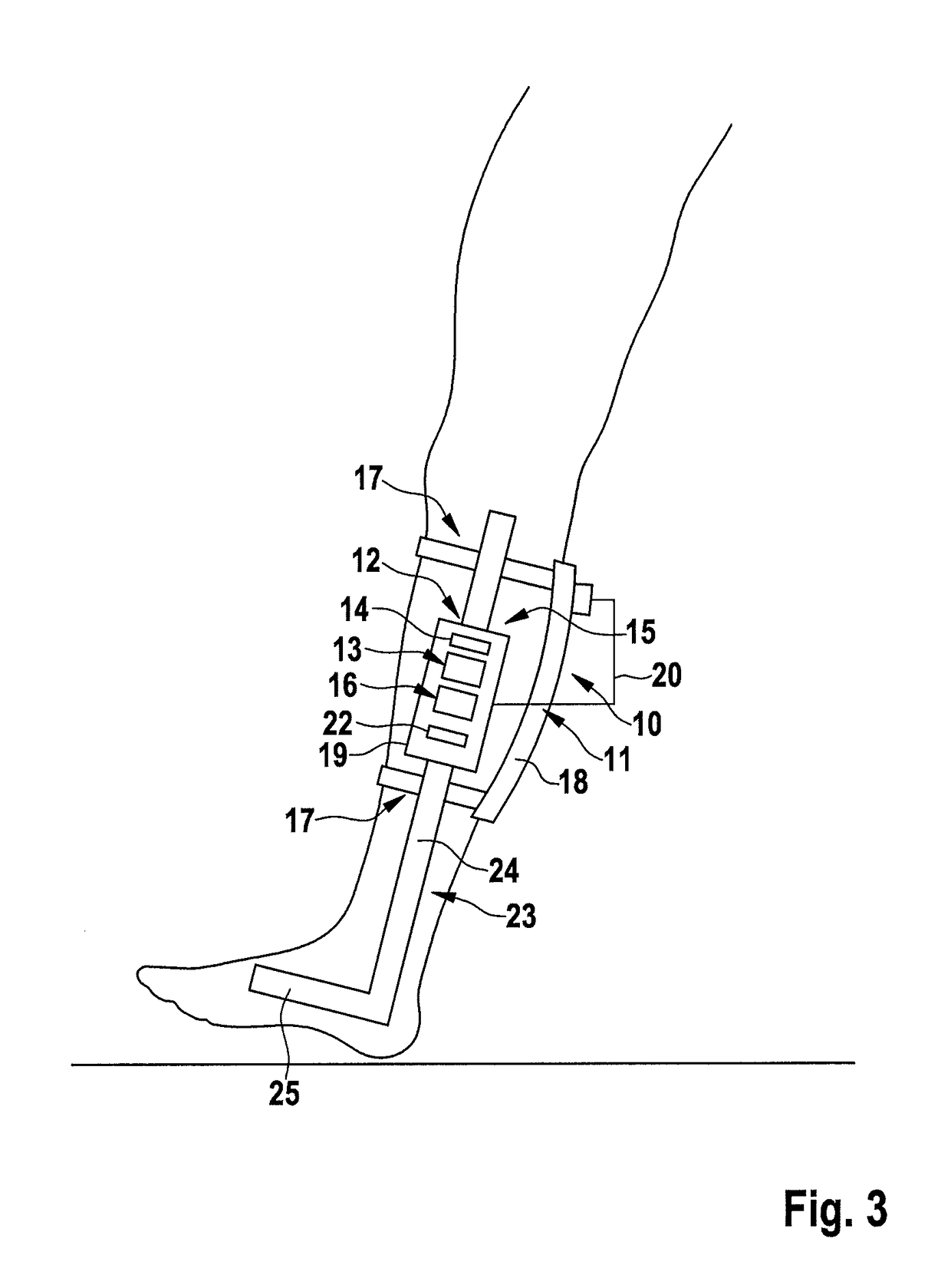 Device and method for electric stimulation of muscles involved in human physiological gait pattern and brace to support an anatomical joint with such device