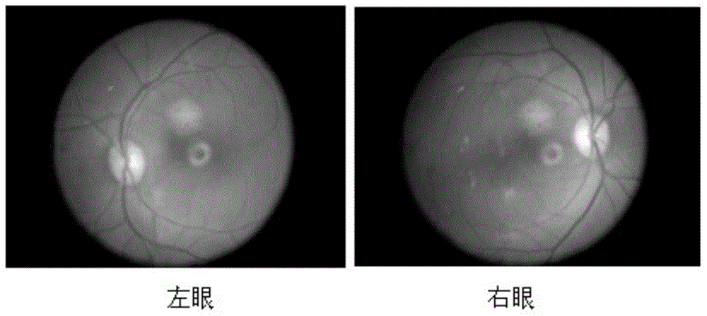 Method for inducing primate macular degeneration model by high fat