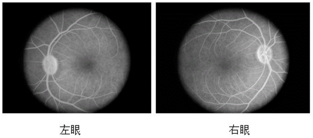 Method for inducing primate macular degeneration model by high fat