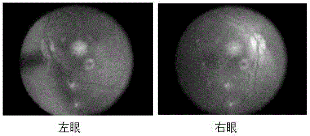 Method for inducing primate macular degeneration model by high fat