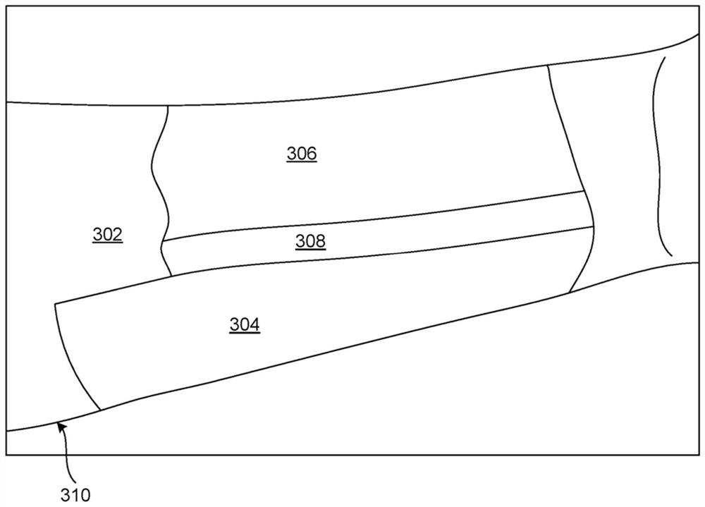 Viscous penis construction template and urethral stent tube for new penis surgery