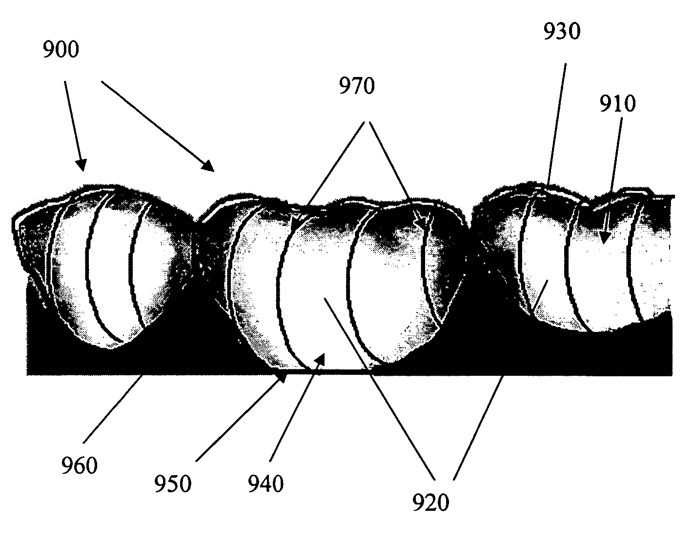 Producing wrinkled dental aligner for dental treatment