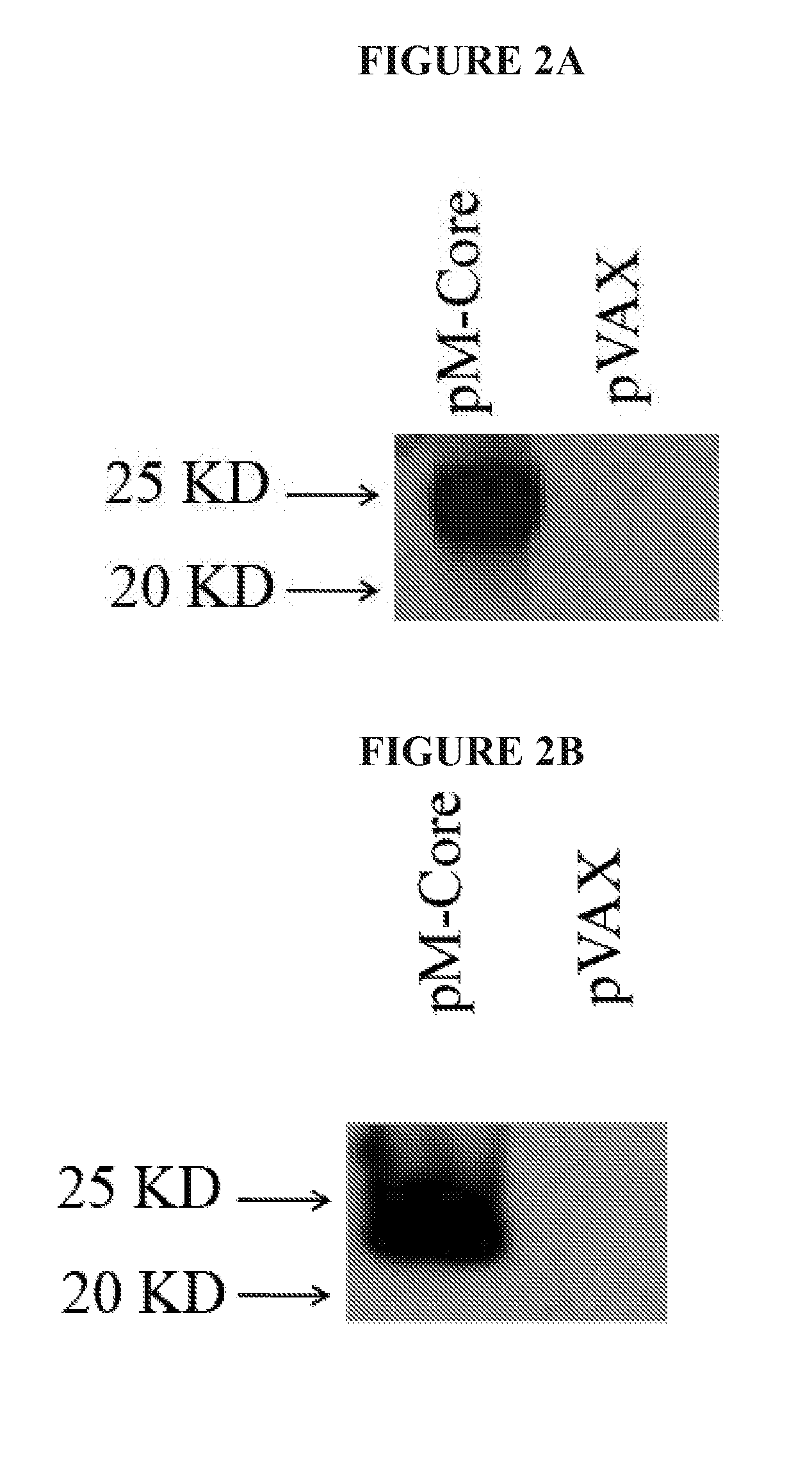 Nucleic Acid Molecule Encoding Hepatitis B Virus Core Protein And Vaccine Comprising The Same