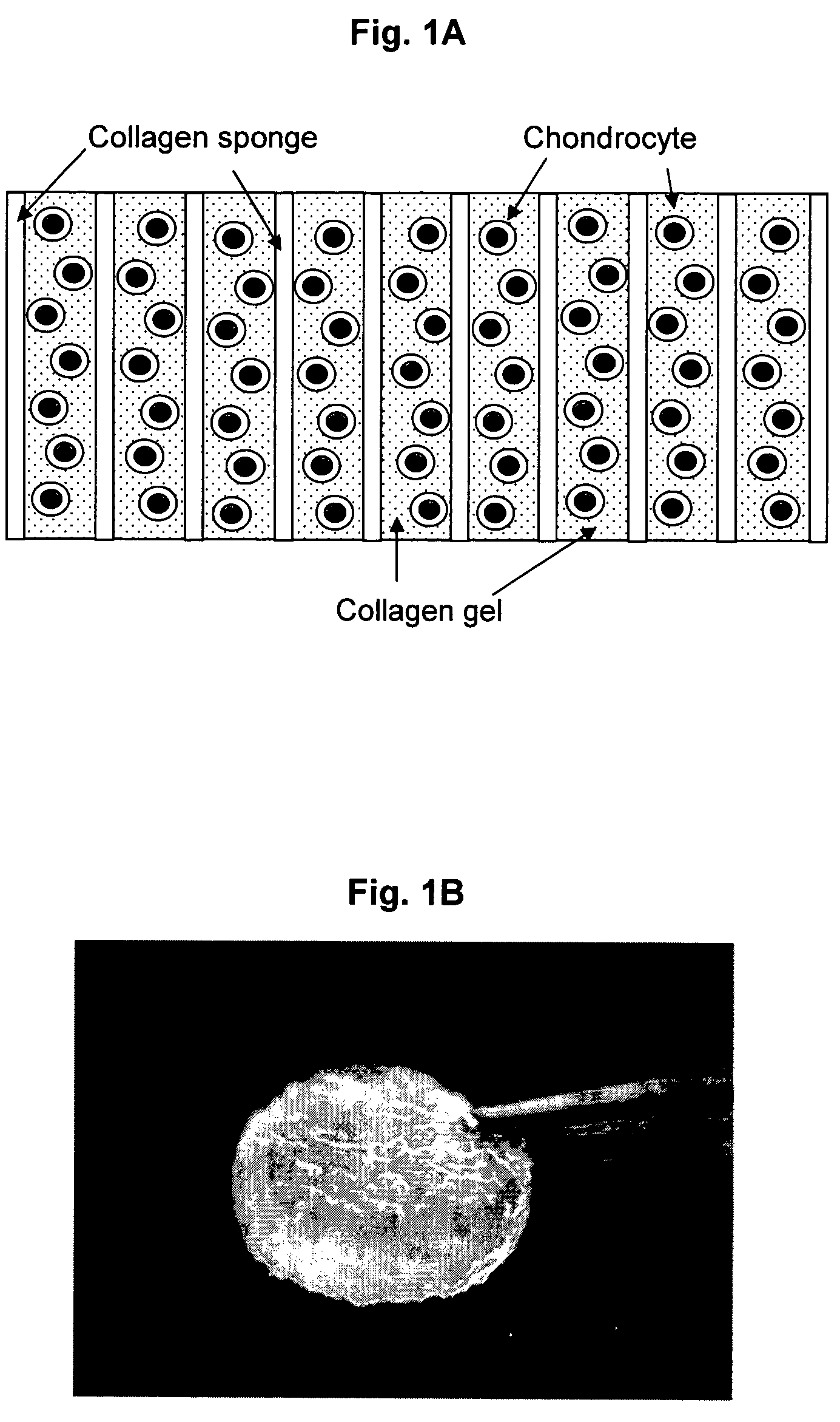 Method for preparing and implanting a cartilage construct to treat cartilage lesions