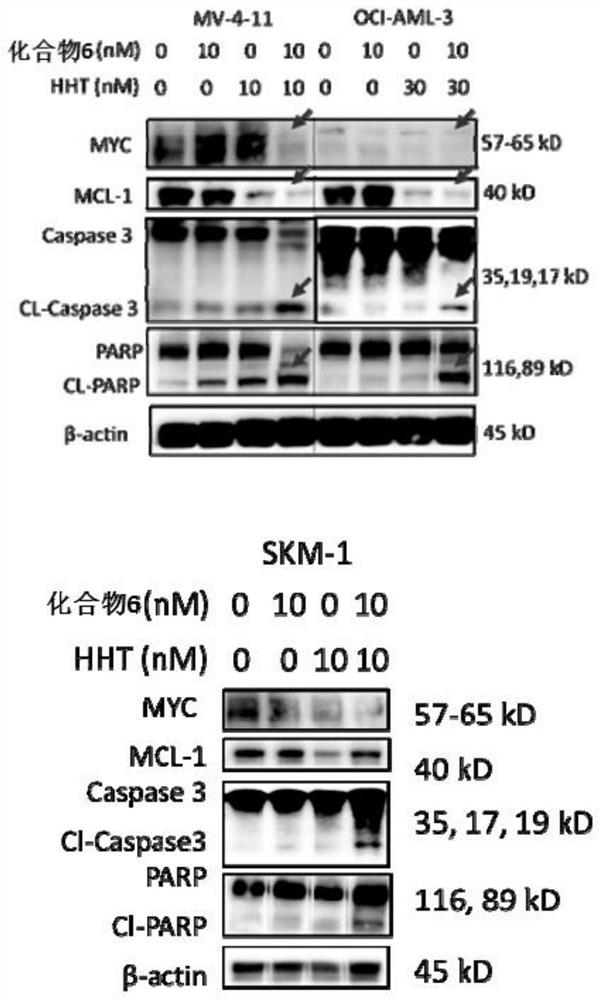 Combined product of Bcl-2/Bcl-xL inhibitor and chemotherapeutic drug and application of combined product in prevention and/or treatment of disease