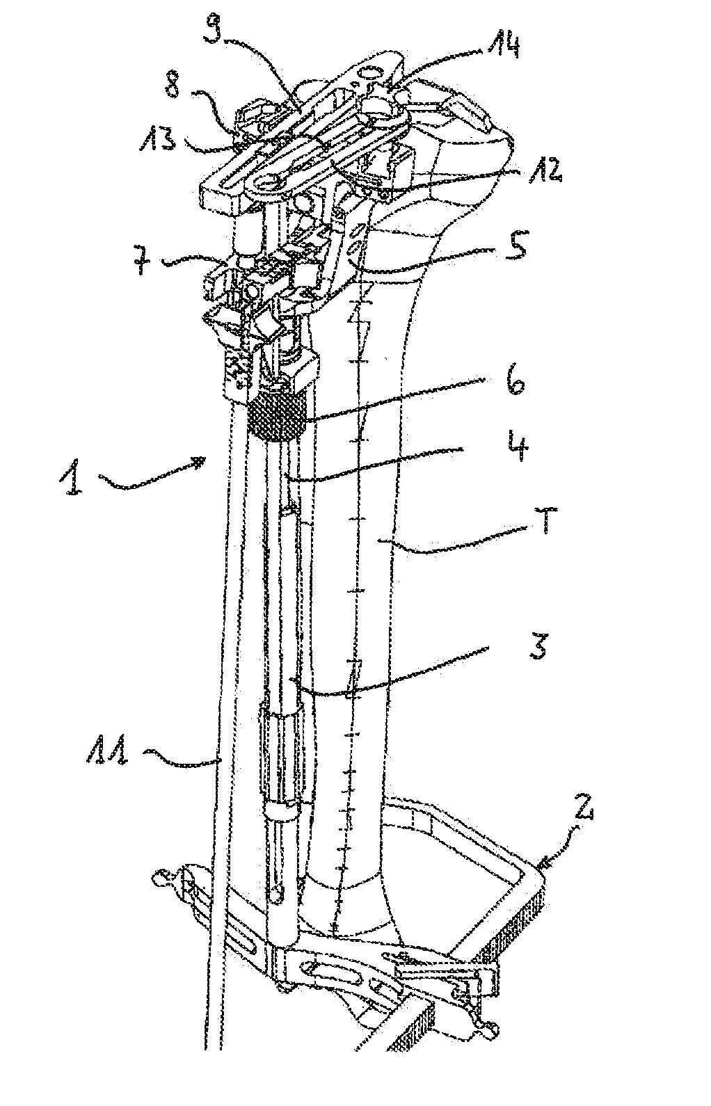 Device for defining a cutting plane for a bone resection