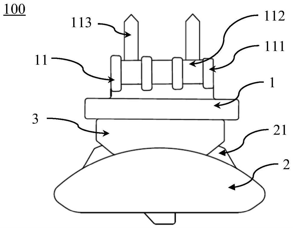 Primary total ankle joint prosthesis