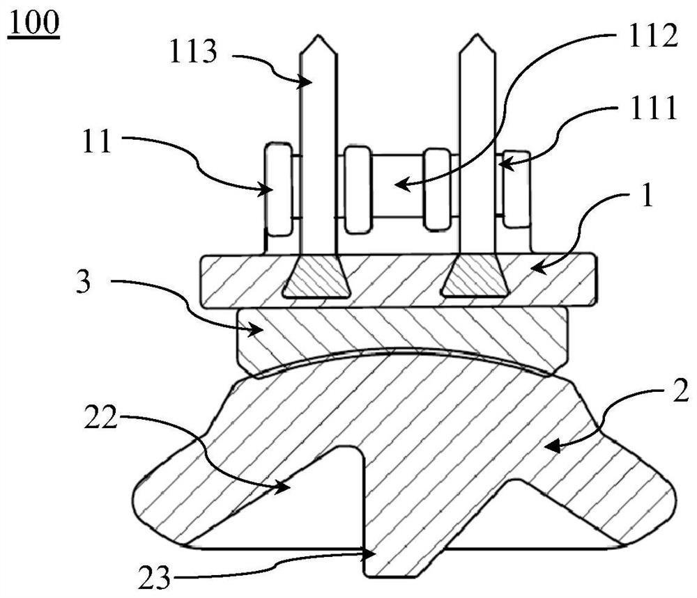 Primary total ankle joint prosthesis