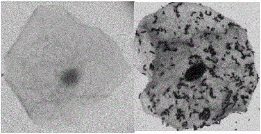 A strain of Lactobacillus crispatus and its pharmaceutical use