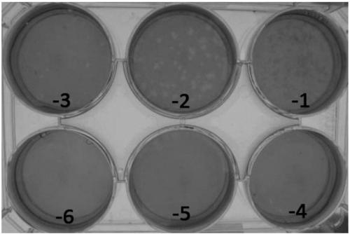 Coxsackie virus CVA16 virulent strain CVA16-B6-714 and application thereof