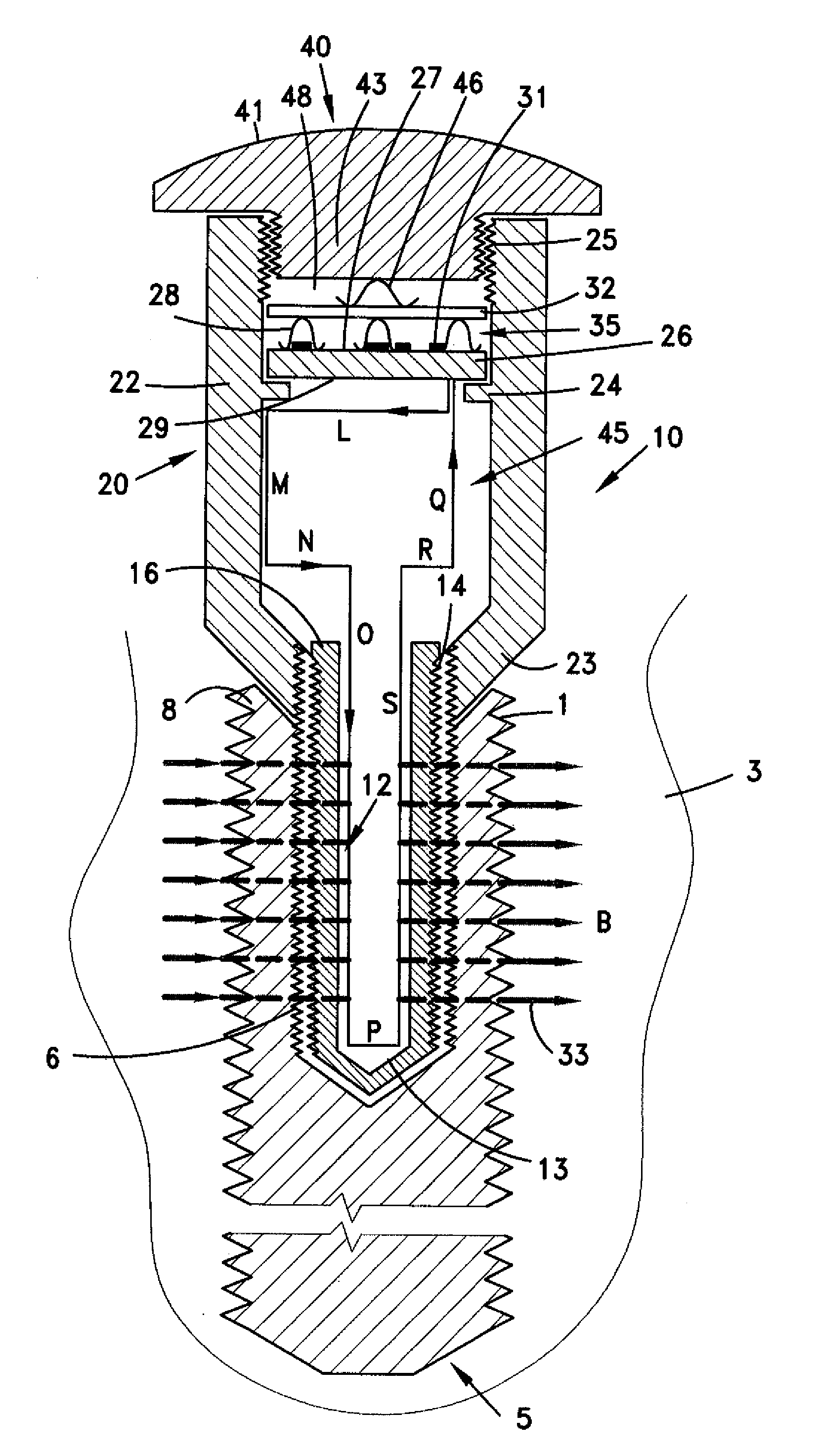 Implant device for stimulating osteogenesis and osseointegration