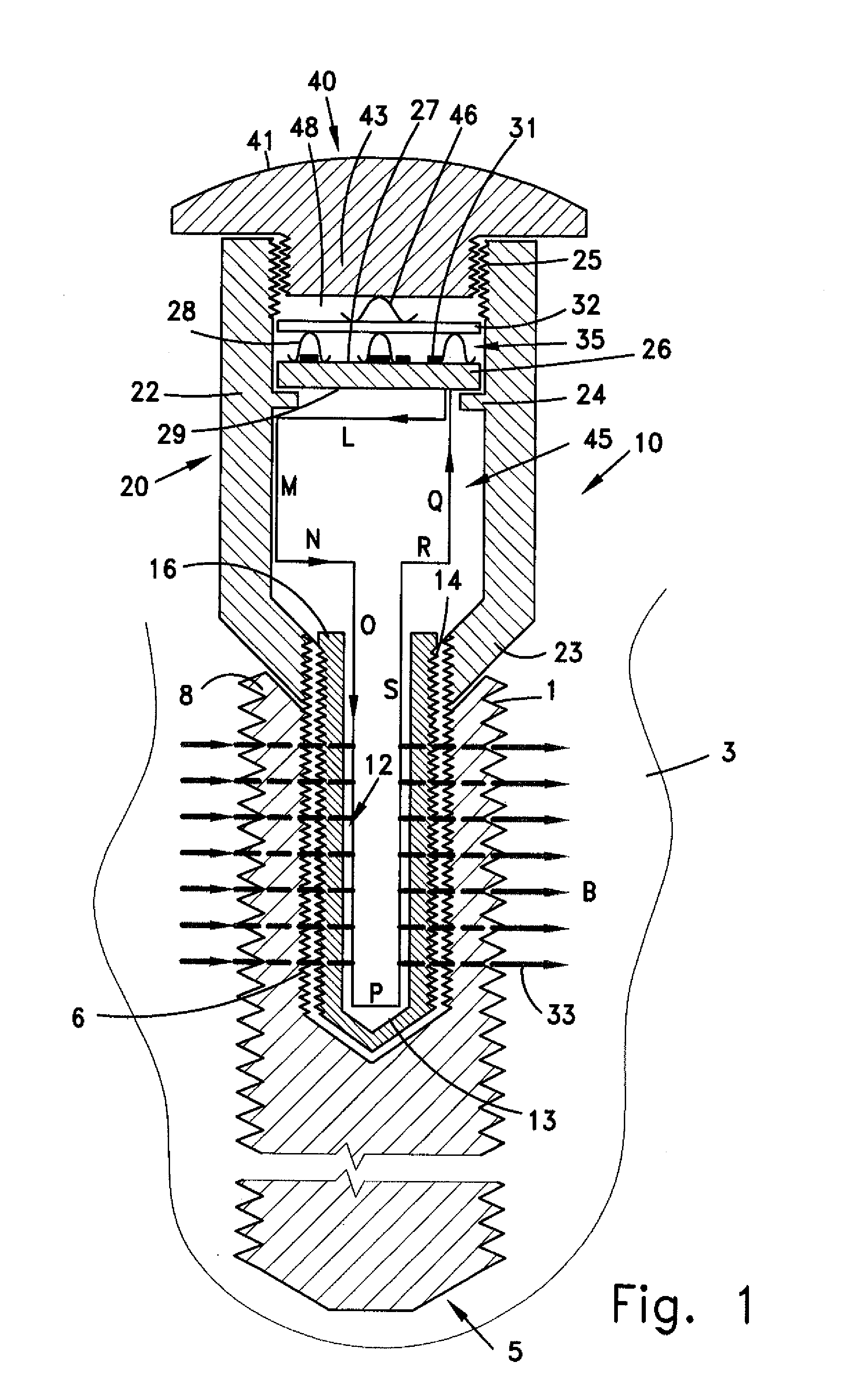 Implant device for stimulating osteogenesis and osseointegration