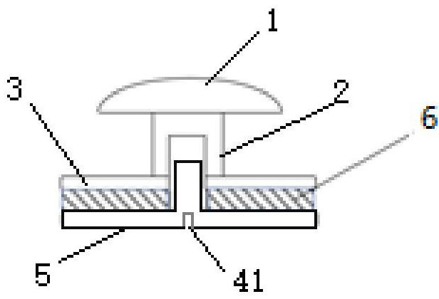 A traction hook added beside the chair of invisible aligners without brackets and its production forceps