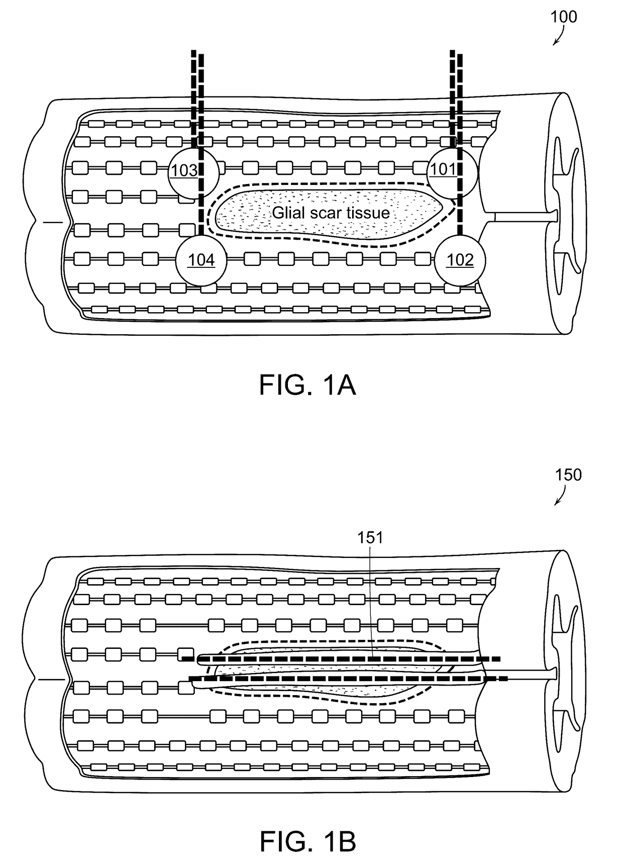 Methods and Systems for Delivery of a Trail of a Therapeutic Substance into an Anatomical Space